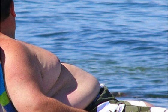 Obesidad, la pandemia del siglo XXI
